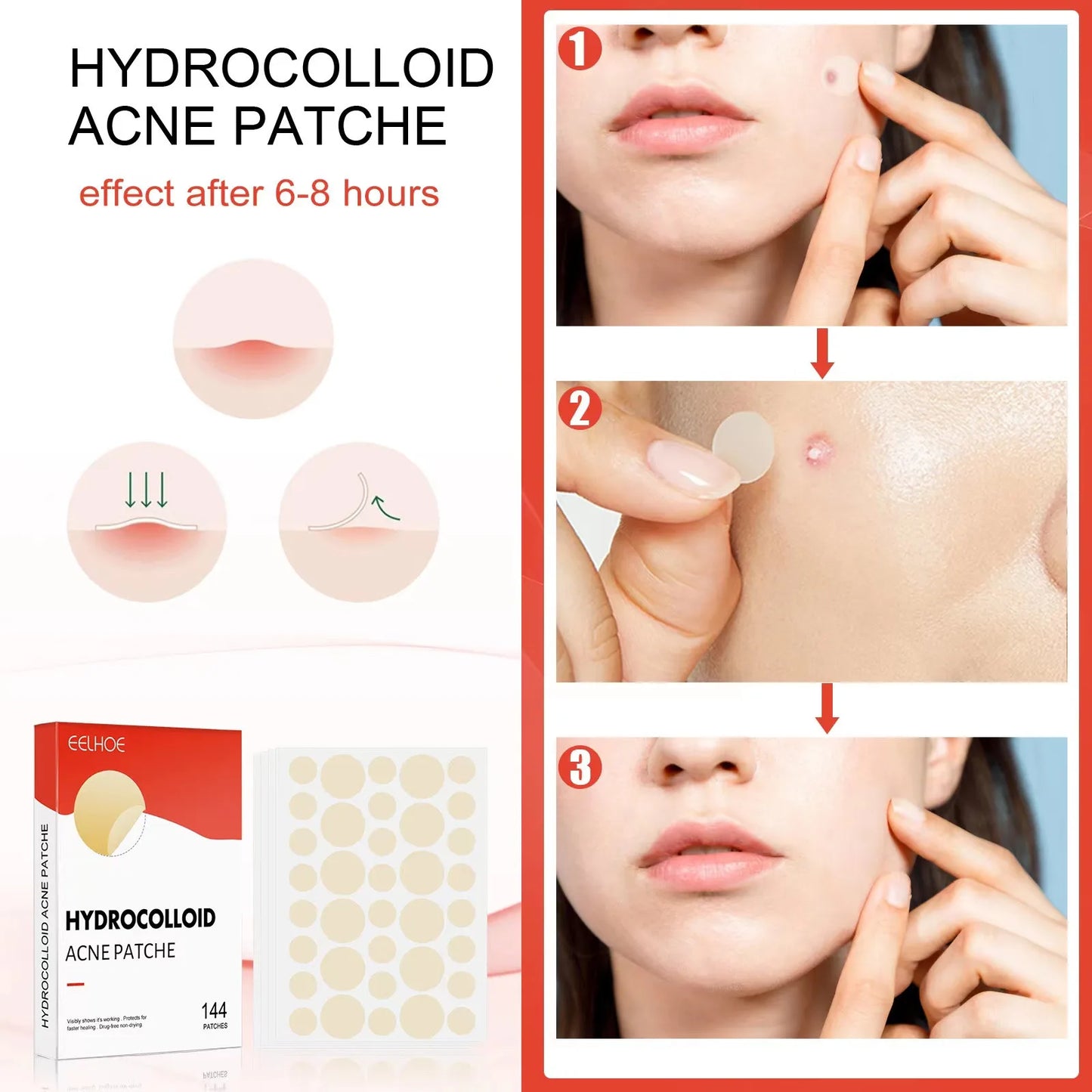 144Pcs/Box Hydrocolloidal Acne Patch Acne Blackhead Cleaner Facial Invisible Waterproof Breathable Acne Repair Patch